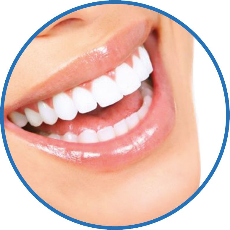 estetica dental