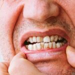 afecciones del tabaco en tus dientes