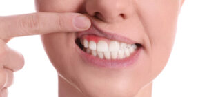 curar la enfermedad periodontal
