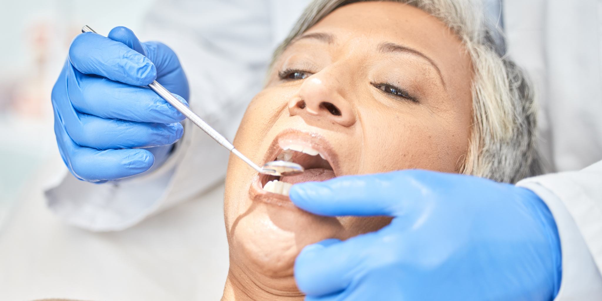 Mitos sobre la endodoncia