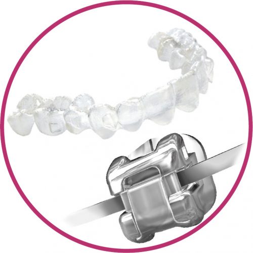 tratamientos dentales