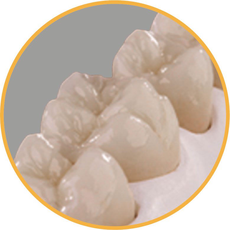 tratamientos dentales
