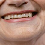 dentista para personas mayores