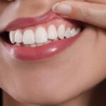 gingivitis tratamiento en argüelles