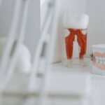 implantes cigomáticos