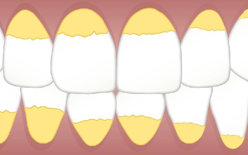 Sarro dental