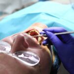 limpieza dental profesionnal en Argúelles