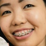 brackets despegados